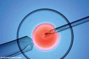 生殖科主任